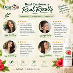 DearSkin Hibiscus Hair Growth Oil with Coconut Oil, Amla, Kalonji, Fenugreek, Curry Leaves & Vetiver Root | Nourishing Herbal Hair Oil for Strong, Healthy-Looking Hair | 100 ml
